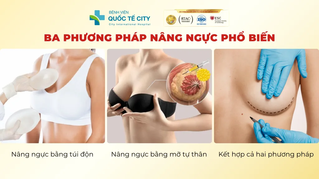 Ba phương pháp nâng ngực phổ biến hiện nay