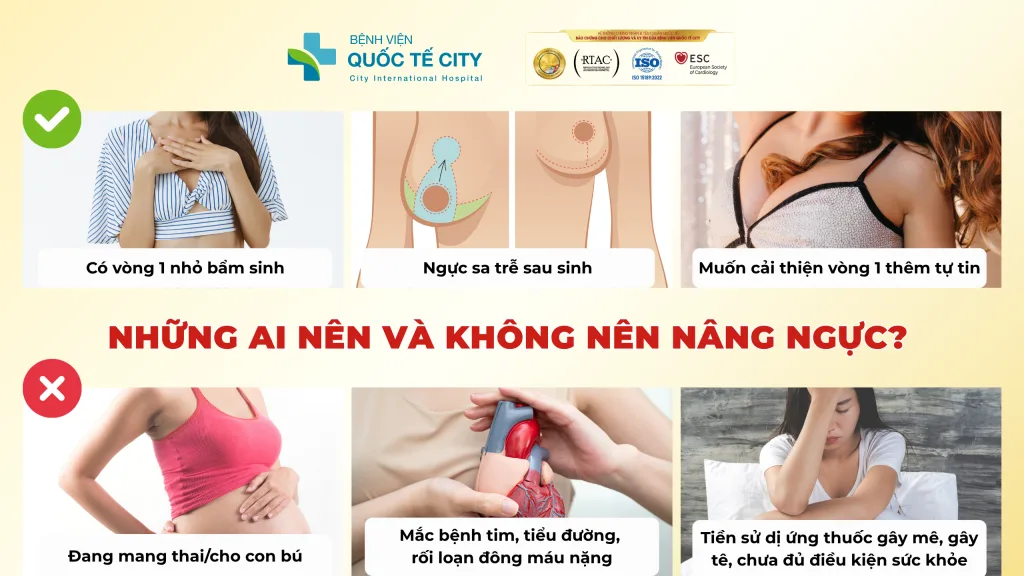 NHỮNG ĐIỀU CẦN BIẾT TRƯỚC KHI NÂNG NGỰC