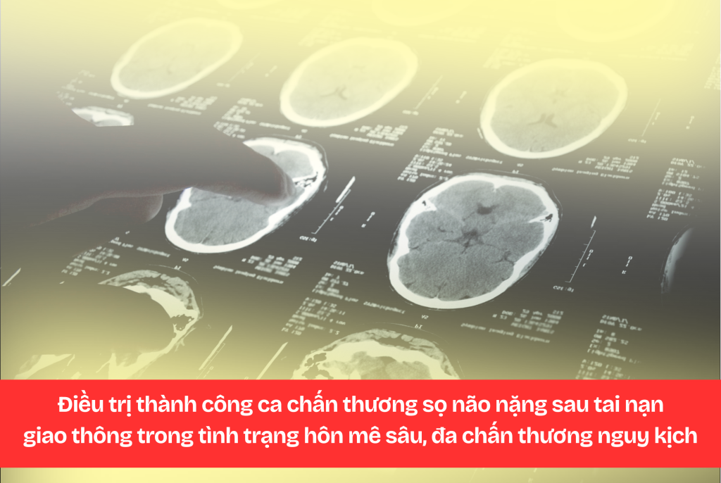 Điều trị thành công ca chấn thương sọ não nặng sau tai nạn giao thông trong tình trạng hôn mê sâu, đa chấn thương nguy kịch (hình ảnh mang tính chất minh họa)