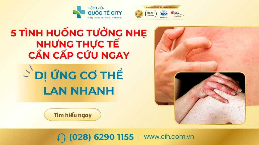 Cấp cứu ngay khi thấy dị ứng cơ thể lan nhanh (một tình trạng nguy hiểm) có thể tiến triển rất nhanh thành sốc phản vệ