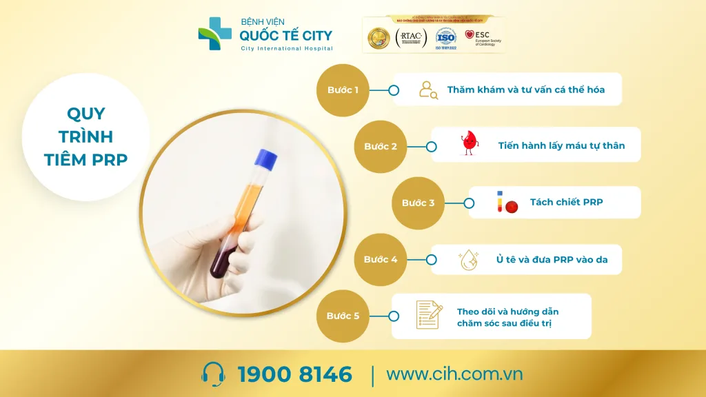 Quy trình tiêm PRP chuẩn y khoa tại bệnh viện