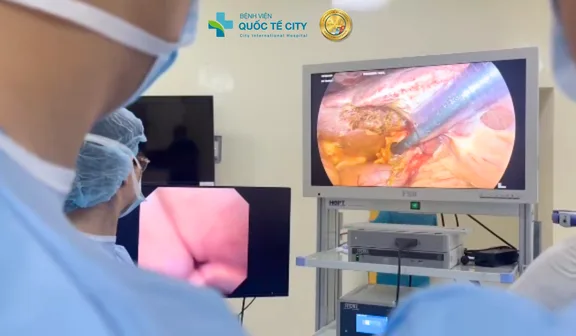 Giải pháp tối ưu là phẫu thuật nội soi lấy sỏi ống mật chủ