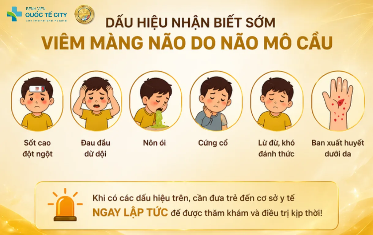Việc nhận biết sớm viêm màng não do não mô cầu là yếu tố then chốt giúp tăng khả năng điều trị thành côn