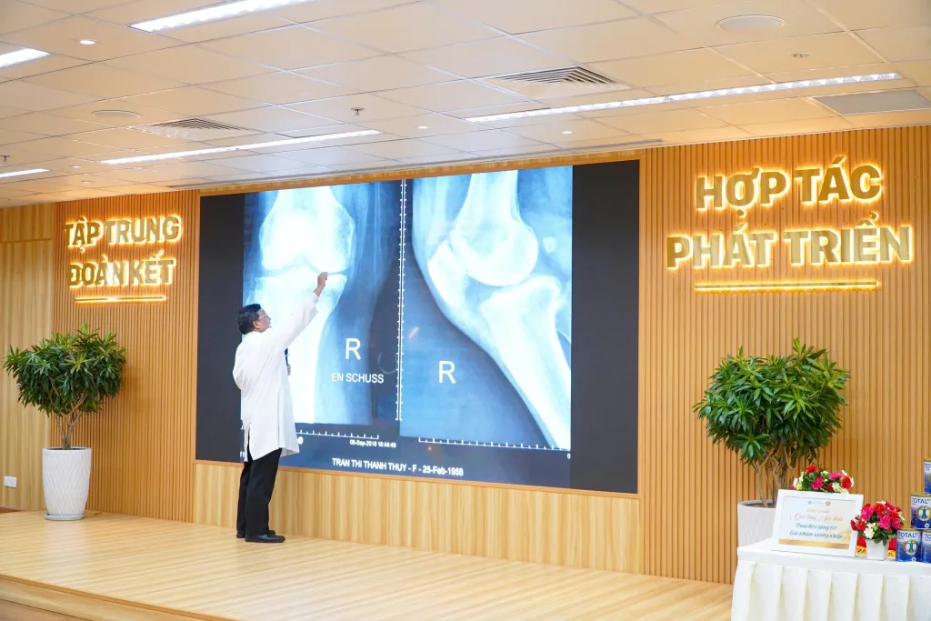 TS. BS. Phạm Chí Lăng – Trưởng Khoa Chấn thương Chỉnh hình Bệnh viện Quốc tế City, Phó Chủ tịch Hội Thay khớp TP.HCM chia sẻ chi tiết về bệnh lý thoái hóa khớp gối